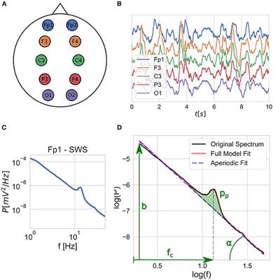 Scale-free and oscillatory spectral measures of sleep stages in humans